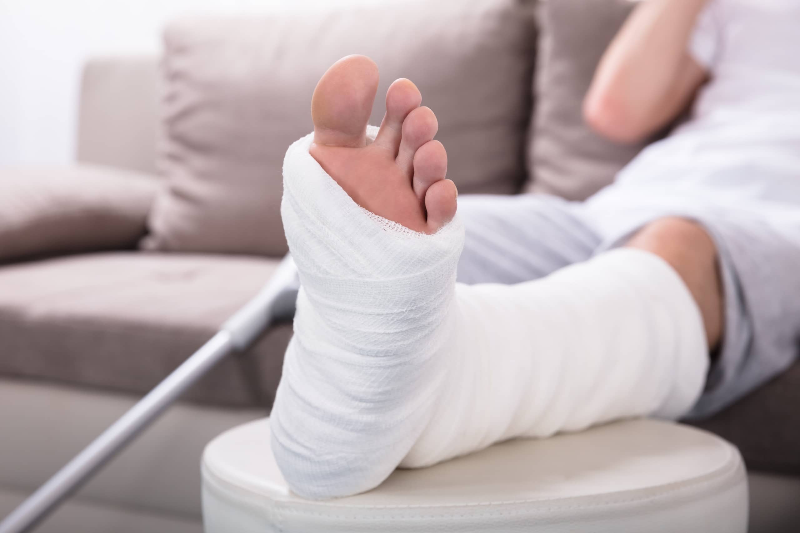 Close up of a man's plastered leg